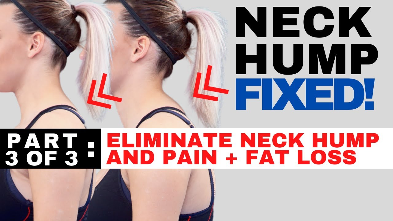 Effective Ways to Lose Neck Fat in 2025 and Get a Sculpted Look!